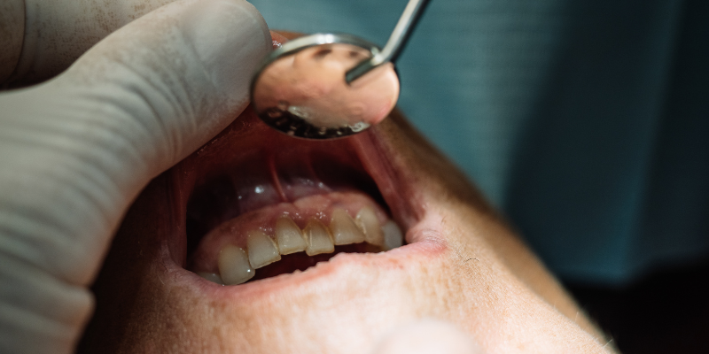 orthodontist near me in Issaquah